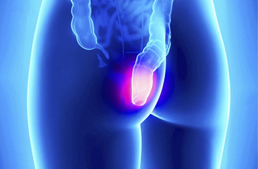 يمكن استخدام Gelarex خارجيًا ومستقيمًا